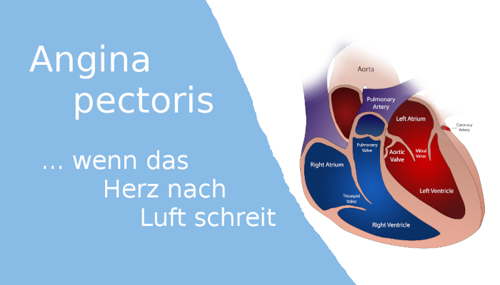 Angina pectoris: Symptome und Behandlung