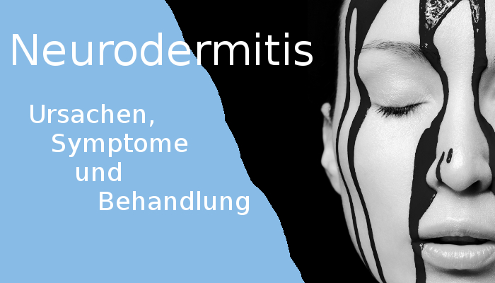 Neurodermitis