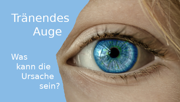 Augenprobleme