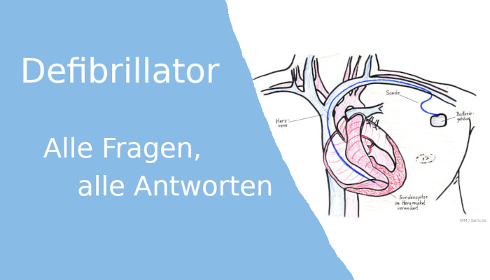 Defibrillator (Defi, ICD): alle Fragen, alle Antworten